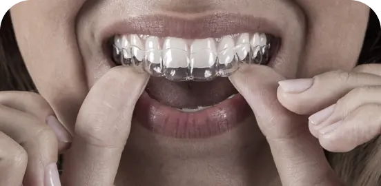 Ortodoncia invisible - Invisalign en San Sebastian de los Reyes. Ortodoncia Sanse